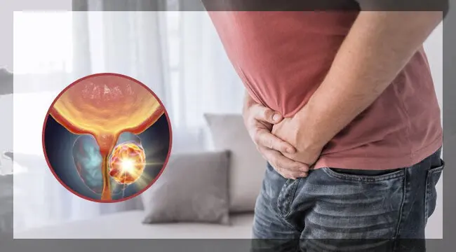 15 EYLÜL PROSTAT KANSERİ FARKINDALIK GÜNÜ